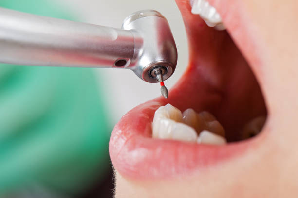 Best Tooth Infection Emergency Dentist  in Butler, OH